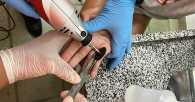 Anel fica preso em dedo de jovem em Minas; bombeiros registraram 59 casos semelhantes em junho