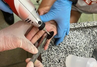 Anel fica preso em dedo de jovem em Minas; bombeiros registraram 59 casos semelhantes em junho
