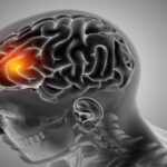 Estudo acende alerta para meningite: queda nas mortes é lenta e pode comprometer meta da OMS